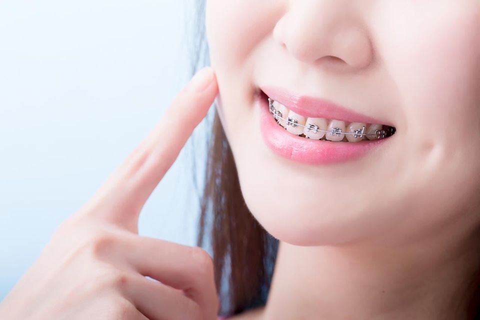 矯正歯科イメージ